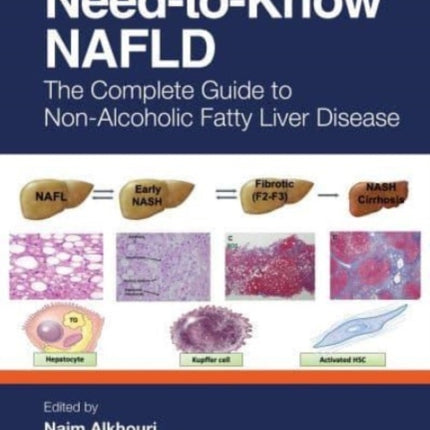 NeedtoKnow NAFLD
