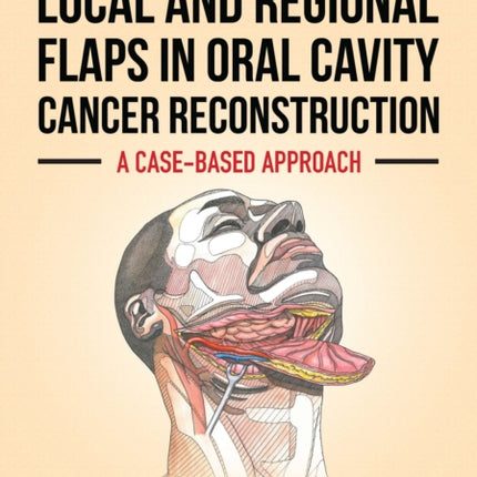 Local and Regional Flaps in Oral Cavity Cancer Reconstruction