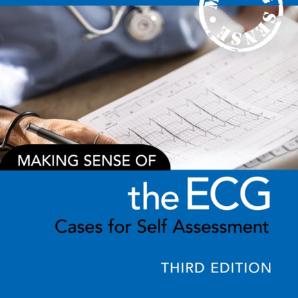 Making Sense of the ECG