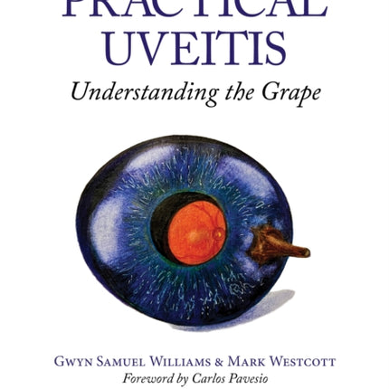 Practical Uveitis