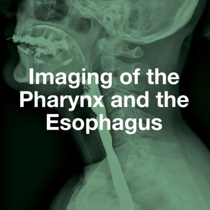Imaging of the Pharynx and the Esophagus