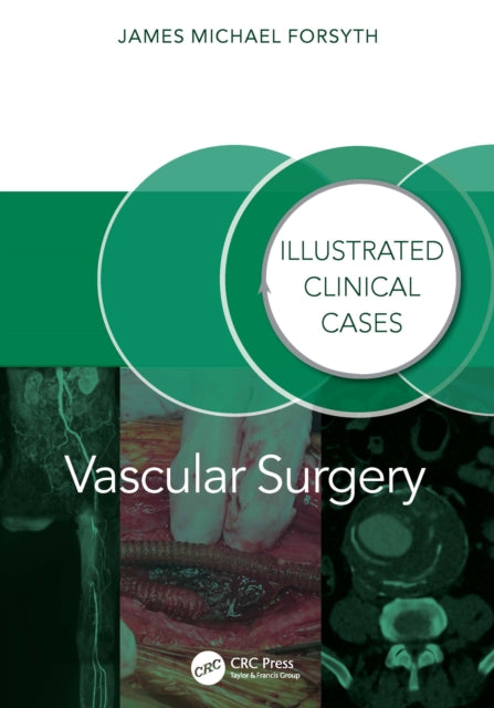 Vascular Surgery