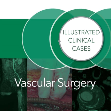Vascular Surgery