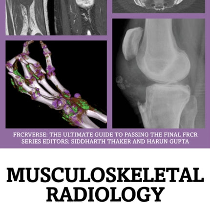 Musculoskeletal Radiology
