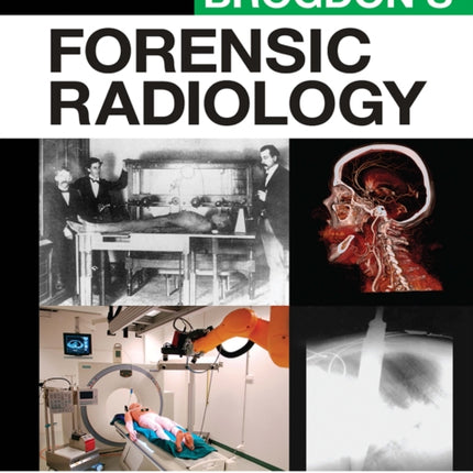 Brogdons Forensic Radiology