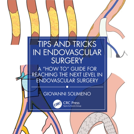 Tips and Tricks in Endovascular Surgery