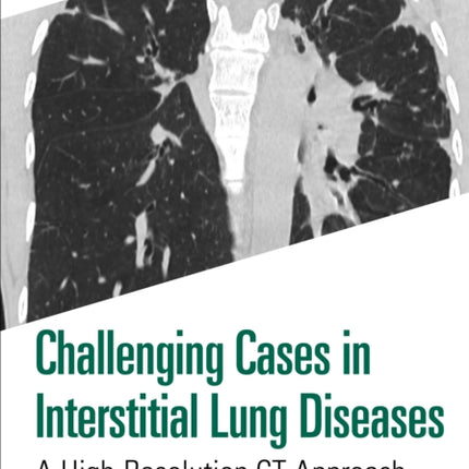 Challenging Cases in Interstitial Lung Diseases