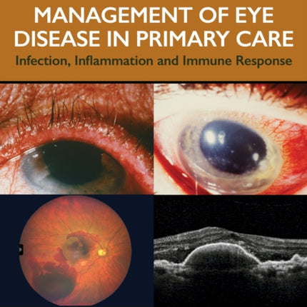 Investigation  Management of Eye Disease in Primary Care