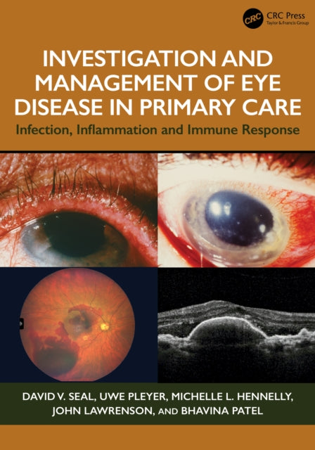 Investigation  Management of Eye Disease in Primary Care