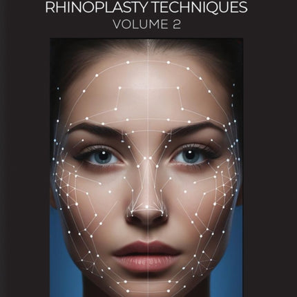 Modern Endonasal Rhinoplasty Techniques  Volume 2