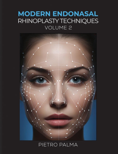 Modern Endonasal Rhinoplasty Techniques  Volume 2