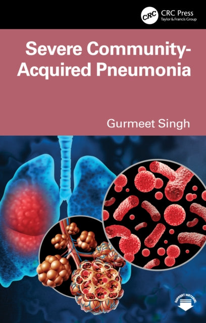 Severe Community Acquired Pneumonia