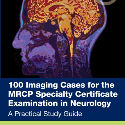 100 Imaging Cases for the MRCPUK Neurology SCE