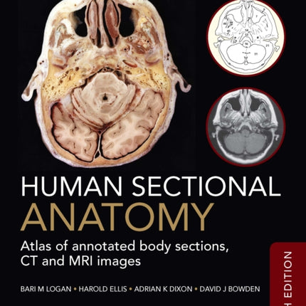 Human Sectional Anatomy