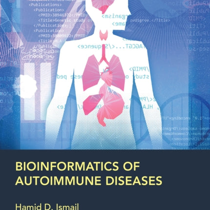 Bioinformatics of Autoimmune Diseases
