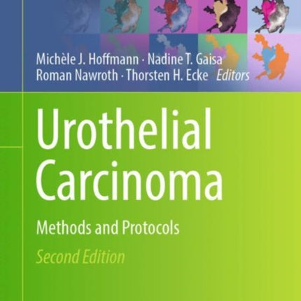 Urothelial Carcinoma: Methods and Protocols