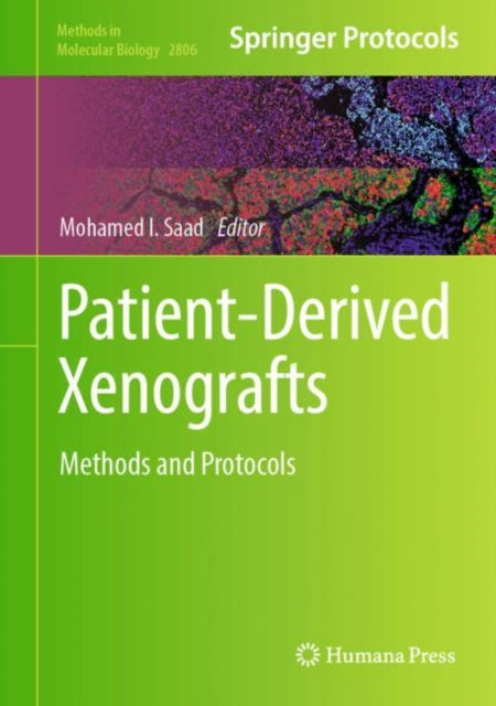 PatientDerived Xenografts