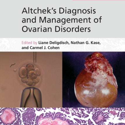 Altcheks Diagnosis and Management of Ovarian Disorders