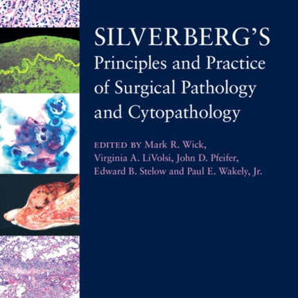 Silverbergs Principles and Practice of Surgical
