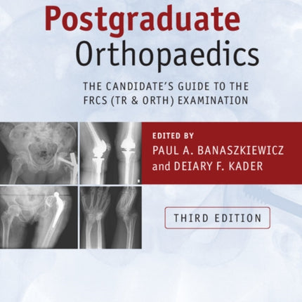 Postgraduate Orthopaedics The Candidates Guide to the FRCS Tr  Orth Examination