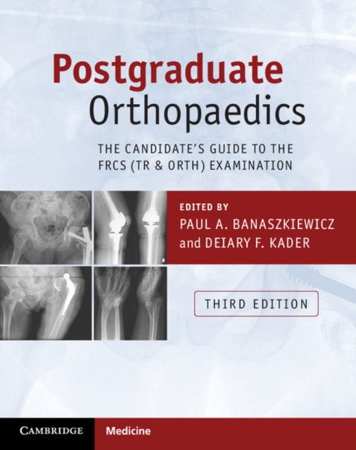 Postgraduate Orthopaedics The Candidates Guide to the FRCS Tr  Orth Examination