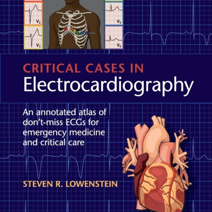 Critical Cases in Electrocardiography An Annotated Atlas of DontMiss ECGs for Emergency Medicine and Critical Care