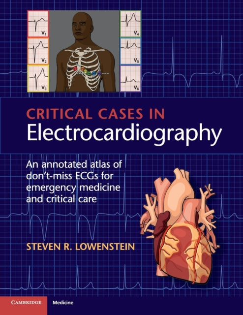 Critical Cases in Electrocardiography An Annotated Atlas of DontMiss ECGs for Emergency Medicine and Critical Care