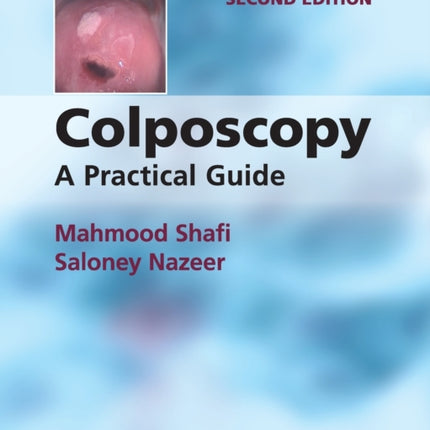 Colposcopy A Practical Guide