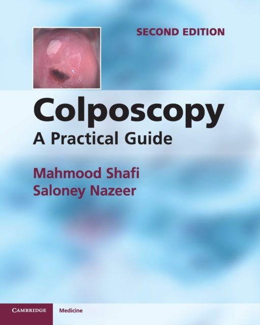Colposcopy A Practical Guide