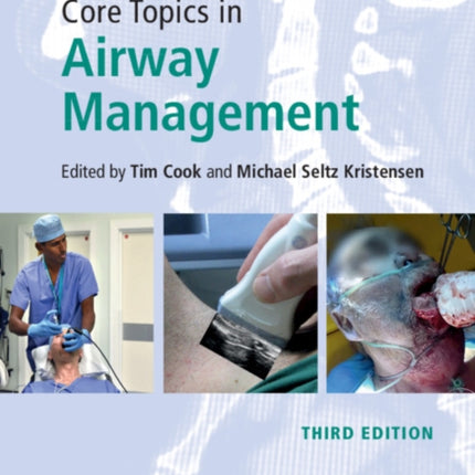 Core Topics in Airway Management