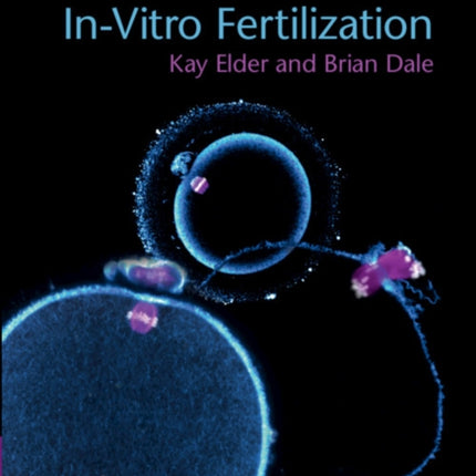 InVitro Fertilization