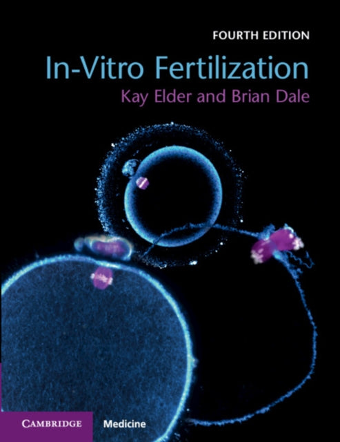InVitro Fertilization