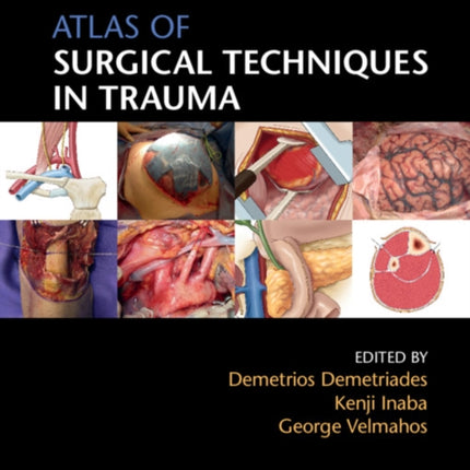 Atlas of Surgical Techniques in Trauma