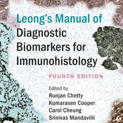 Leong's Manual of Diagnostic Biomarkers for Immunohistology