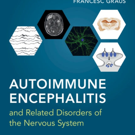 Autoimmune Encephalitis and Related Disorders of