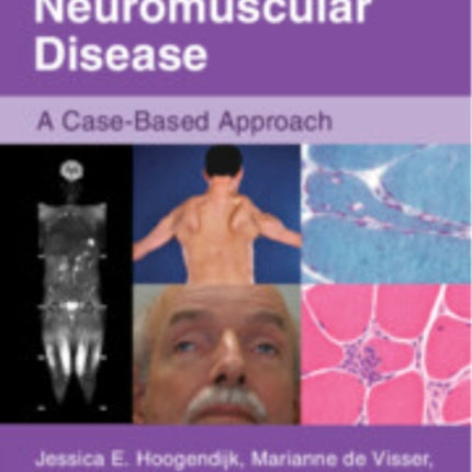 Neuromuscular Disease