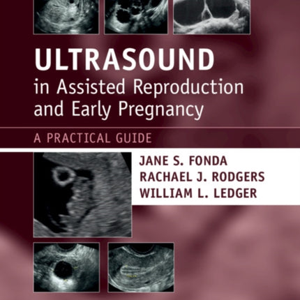 Ultrasound in Assisted Reproduction and Early