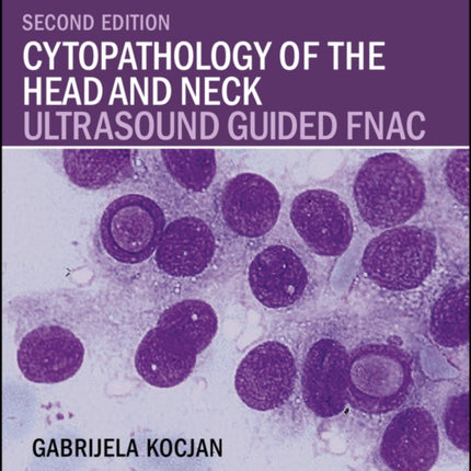 Cytopathology of the Head and Neck: Ultrasound Guided FNAC