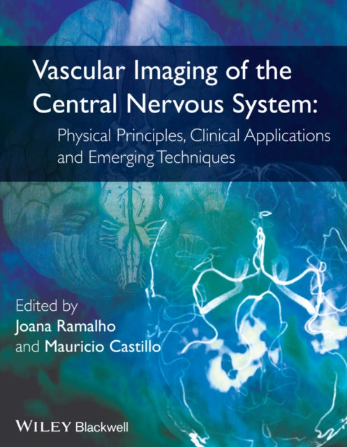 Vascular Imaging of the Central Nervous System: Physical Principles, Clinical Applications, and Emerging Techniques