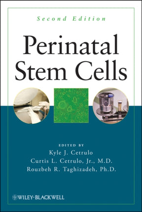 Perinatal Stem Cells