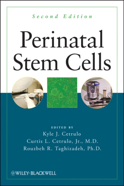 Perinatal Stem Cells