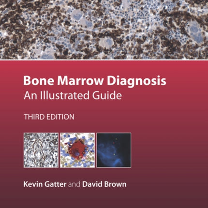 Bone Marrow Diagnosis: An Illustrated Guide