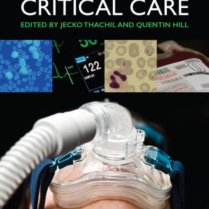 Haematology in Critical Care: A Practical Handbook