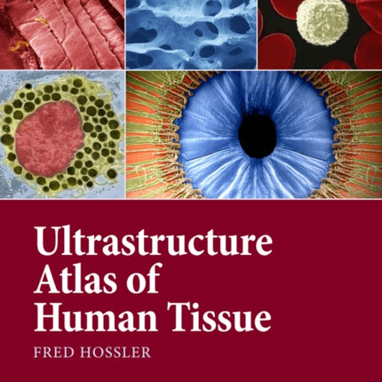 Ultrastructure Atlas of Human Tissues