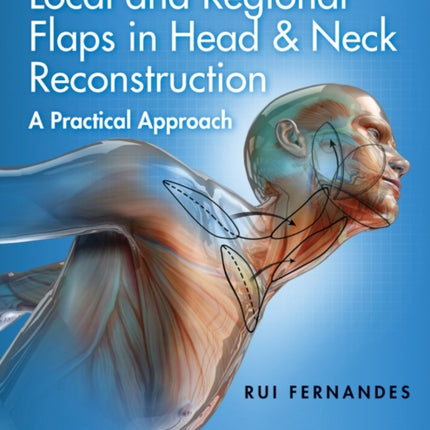 Local and Regional Flaps in Head and Neck