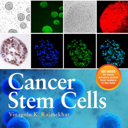 Cancer Stem Cells