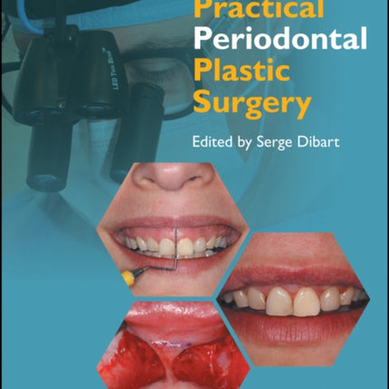 Practical Periodontal Plastic Surgery