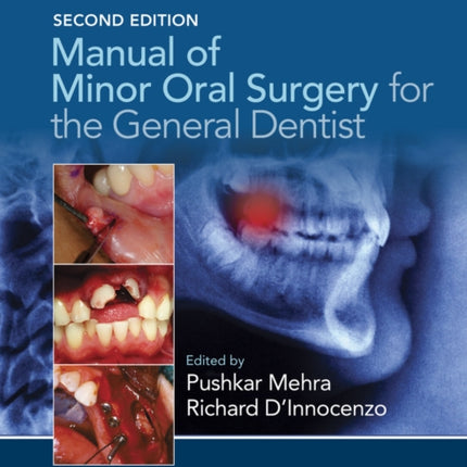 Manual of Minor Oral Surgery for the General