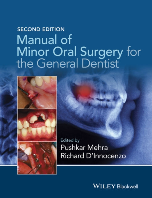 Manual of Minor Oral Surgery for the General