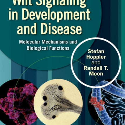 Wnt Signaling in Development and Disease